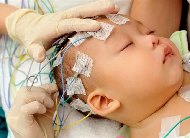 electrodes-eeg-on-child