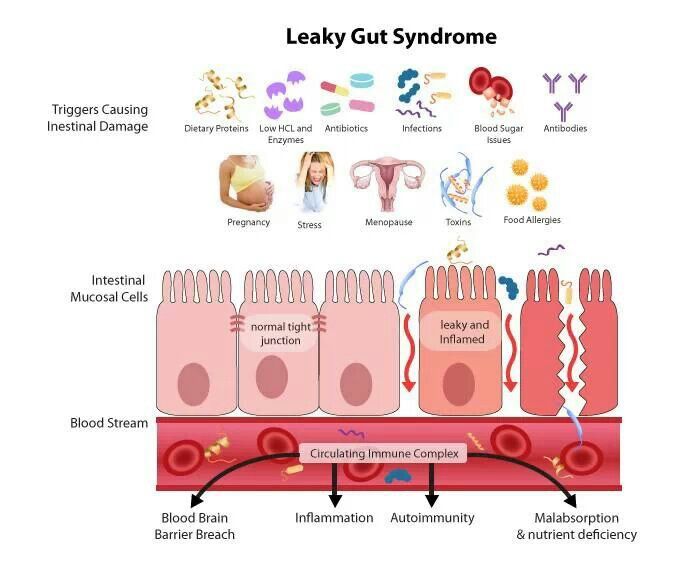how does leaky gut syndrome work overview